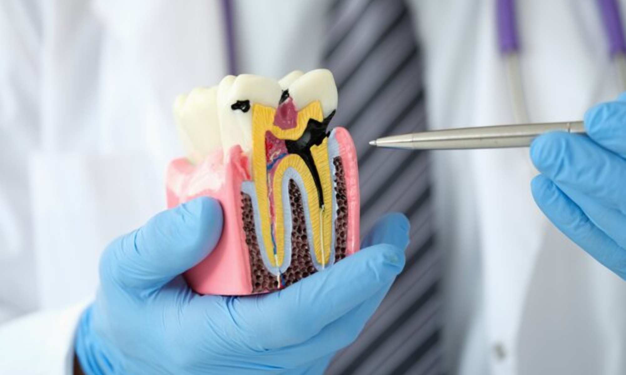 is root canal treatment painful
