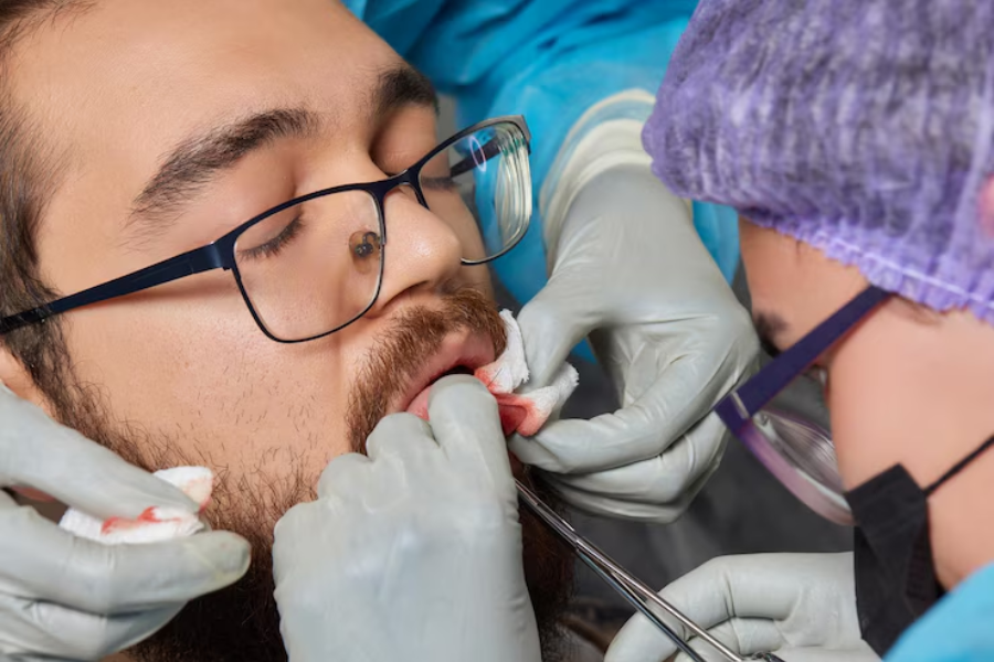stop tooth extraction bleeding