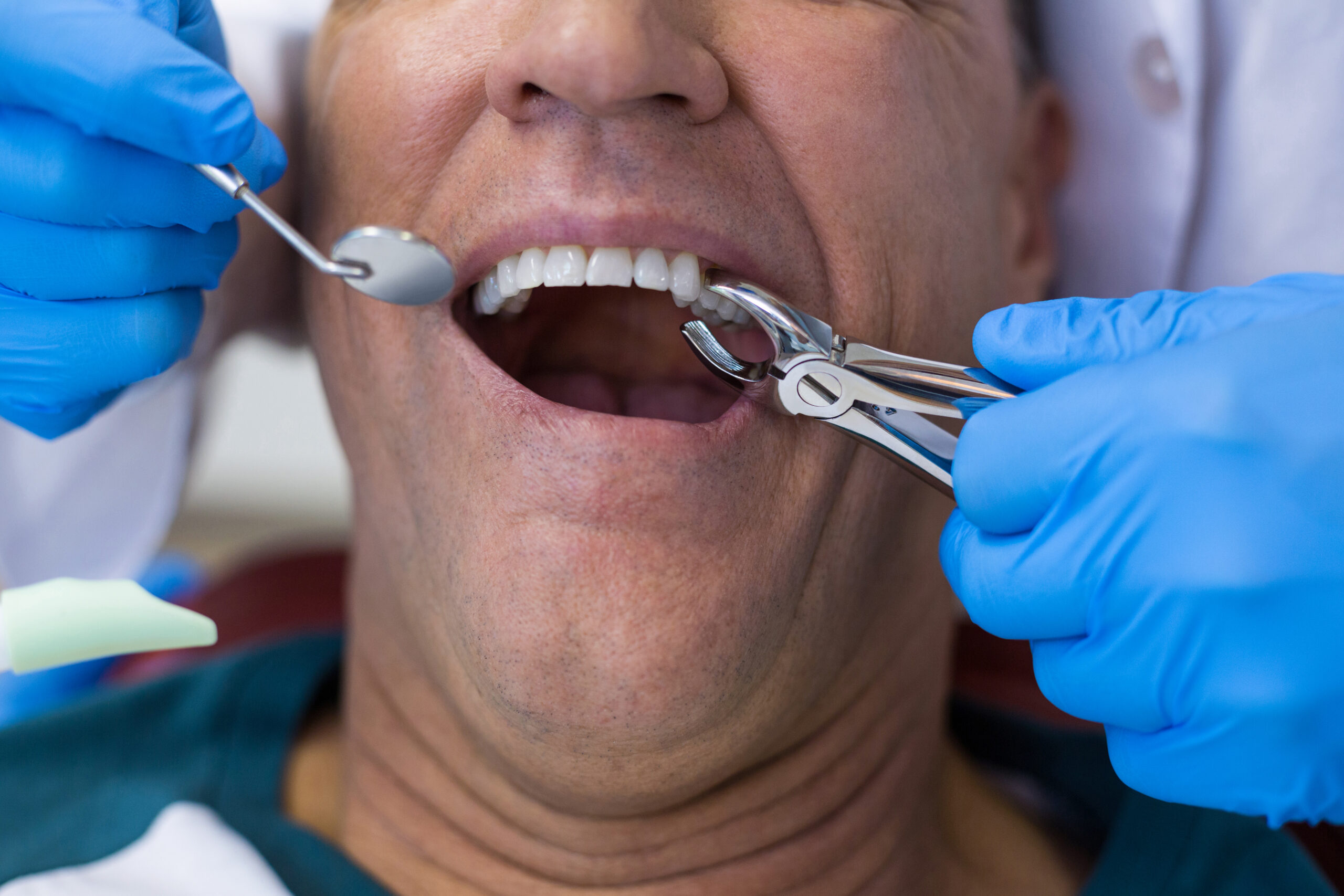 how to care for your mouth after tooth extraction