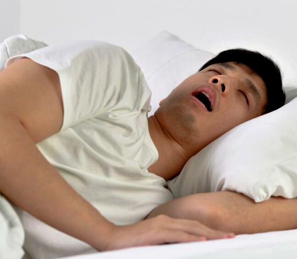 Man sleeping and snoring due to airway obstruction