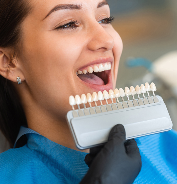 dental veneers materials