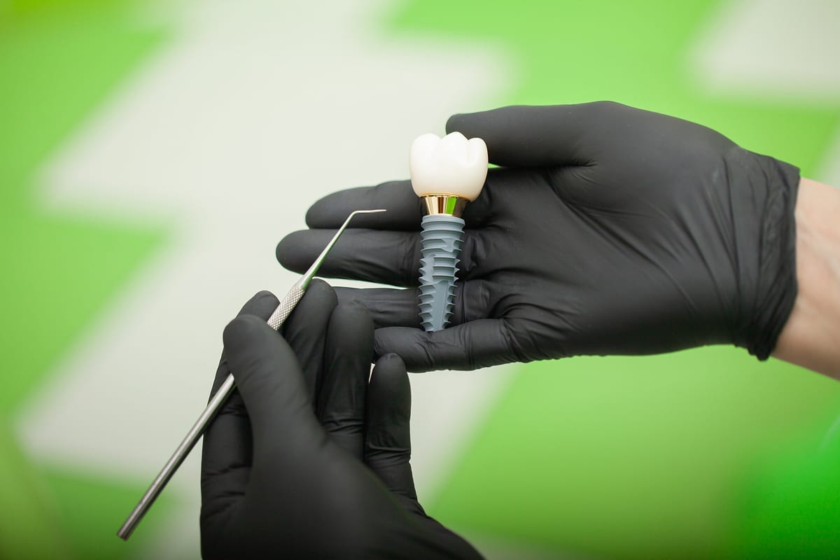Dental Implants in Denville